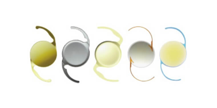 眼内レンズの選択肢が豊富(多焦点眼内レンズもあり)