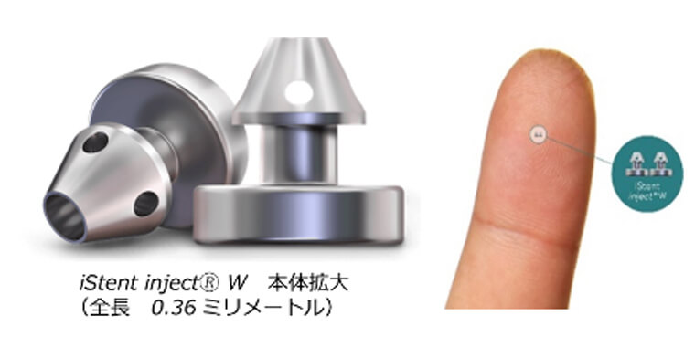 白内障・緑内障同時手術にも対応